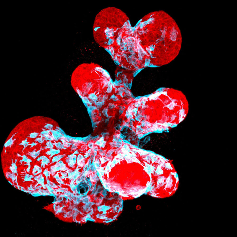 Органоїд грудей, що показує скорочувальні міоепітеліальні клітини (синій), що повзає по секреторних клітинах грудей (червоний)