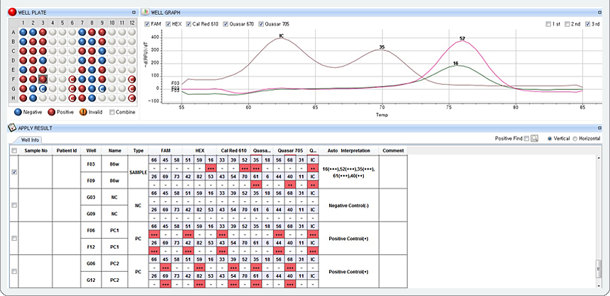 На малюнку зображено приклад результату тесту, який показує наявність коінфекції: ВПЛ 16 високий (+++) у каналі HEX, ВПЛ 52 високий (+++) у каналі Cal Red 610, ВПЛ 35, 61 високі (+++) у каналі Quasar 670, а HPV 40 - середній (++) у каналі Quasar 705. 