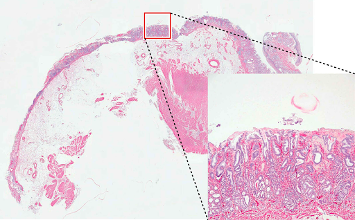 Тканини шлунку, фарбування SMA. 17x12 Tiled images (Об’єктив: CFI Plan Apochromat 40XC)
