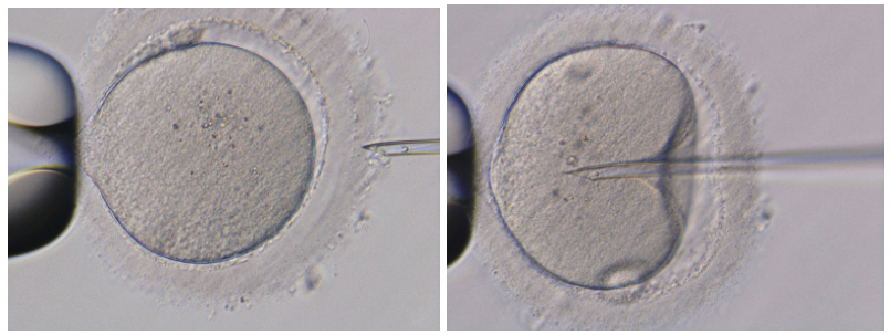 Чітке зображення сперматозоїда в піпетці для ін’єкцій.