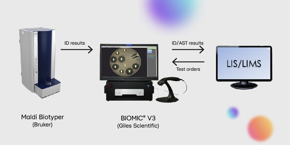 Переваги мікробіологічного аналізатора BIOMIC V3